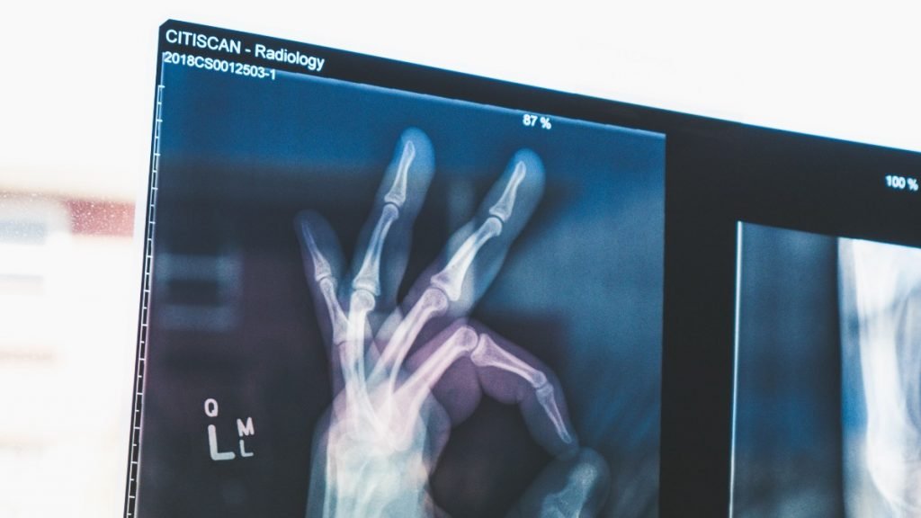 What to Do with Old XRays? SustainabilityNook